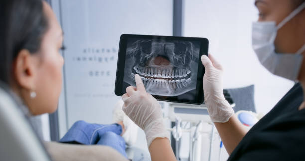 Licensed Dental Implants service in West Fargo, ND - Smile Center Dentistry